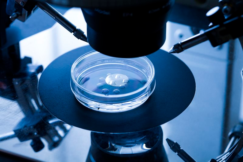 Imagen: Science Photo Library
